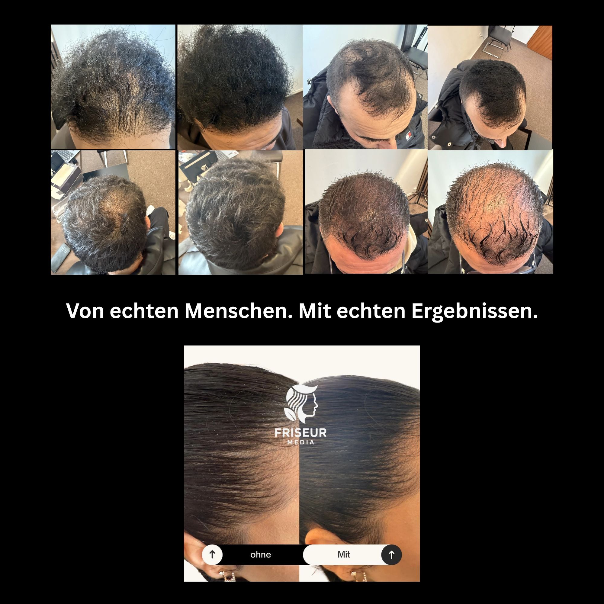 FriseurMedia Streuhaar zur Haarverdichtung & vollem Haar in Sekunden – 3-in-1 Komplett-Set